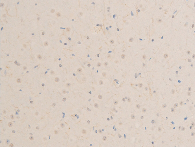 MITF Antibody - 1:100 staining mouse brain tissue by IHC-P. The tissue was formaldehyde fixed and a heat mediated antigen retrieval step in citrate buffer was performed. The tissue was then blocked and incubated with the antibody for 1.5 hours at 22°C. An HRP conjugated goat anti-rabbit antibody was used as the secondary.