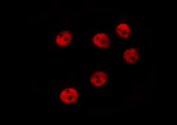 MITF Antibody - Staining COS7 cells by IF/ICC. The samples were fixed with PFA and permeabilized in 0.1% Triton X-100, then blocked in 10% serum for 45 min at 25°C. The primary antibody was diluted at 1:200 and incubated with the sample for 1 hour at 37°C. An Alexa Fluor 594 conjugated goat anti-rabbit IgG (H+L) Ab, diluted at 1/600, was used as the secondary antibody.