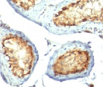 Mitochondria Antibody - IHC testing of FFPE human testicular carcinoma with Mitochondrial Marker antibody (clone 113-1) This image was taken for the unmodified form of this product. Other forms have not been tested.