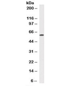 Mitochondria Antibody - Western blot testing of human HeLa cell lysate with Mitochondrial Marker antibody (clone 113-1). This image was taken for the unmodified form of this product. Other forms have not been tested.