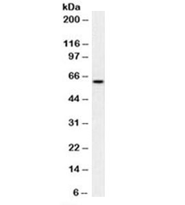 Mitochondria Antibody - Western blot testing of human HeLa cell lysate with Mitochondria antibody (clone MTC02). This image was taken for the unmodified form of this product. Other forms have not been tested.