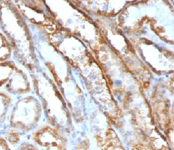 Mitochondria Antibody - IHC testing of FFPE human renal cell carcinoma with Mitochondrial antibody (clone MTC719) This image was taken for the unmodified form of this product. Other forms have not been tested.