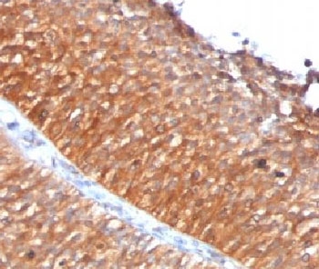 Mitochondria Antibody - IHC testing of FFPE human bladder carcinoma with Mitochondrial antibody (clone MTC719) This image was taken for the unmodified form of this product. Other forms have not been tested.