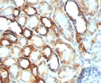Mitochondria Antibody - IHC testing of FFPE human renal cell carcinoma with Mitochondria marker antibody (clone MTC754) This image was taken for the unmodified form of this product. Other forms have not been tested.