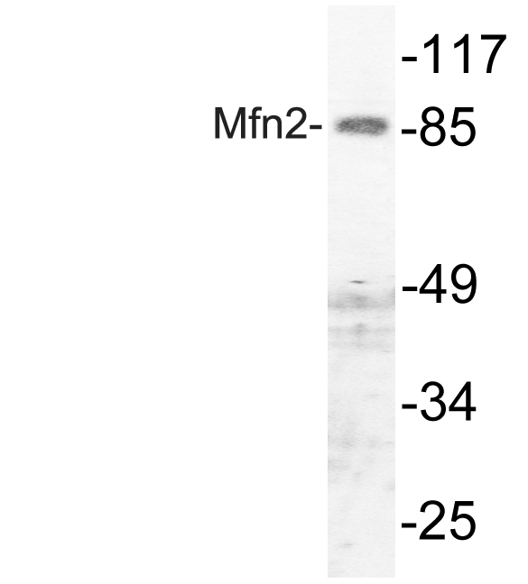 Mitofusin 2 / MFN2 Antibody - Western blot analysis of lysate from HUVEC cells, using Mfn2 antibody.