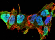 Mitofusin 2 / MFN2 Antibody - Detection of Mitofusin-2 in neuroblastoma cell line SK-N-BE with Mitofusin-2 Monoclonal Antibody at 10ug/ml: DAPI (blue) nuclear stain, Texas Red F actin stain, ATTO 488 (green) Mitofusin-2 stain.
