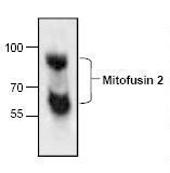 Mitofusin 2 / MFN2 Antibody - Western blot of Mitofusin 2 / MFN2 antibody.