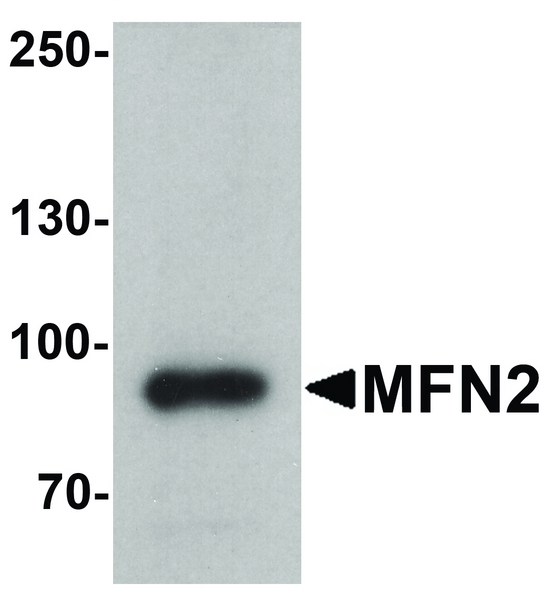Mitofusin 2 / MFN2 Antibody - Western blot analysis of MFN2 in human brain tissue lysate with MFN2 antibody at 1 ug/ml.