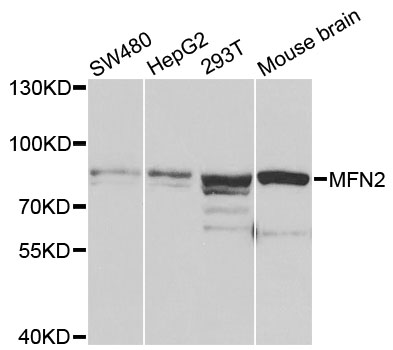 Mitofusin 2 / MFN2 Antibody - Western blot analysis of extracts of various cell lines, using MFN2 antibody at 1:1000 dilution. The secondary antibody used was an HRP Goat Anti-Rabbit IgG (H+L) at 1:10000 dilution. Lysates were loaded 25ug per lane and 3% nonfat dry milk in TBST was used for blocking.