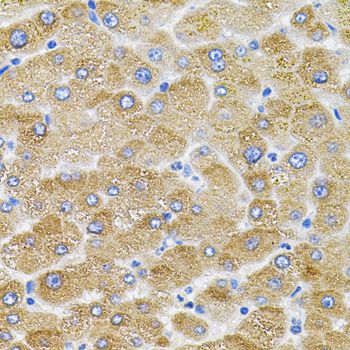 Mitofusin 2 / MFN2 Antibody - Immunohistochemistry of paraffin-embedded human liver injury using MFN2 antibody (40x lens).