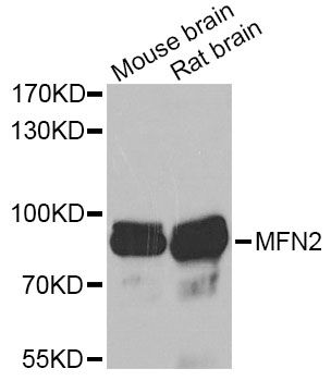 Mitofusin 2 / MFN2 Antibody - Western blot analysis of extracts of various cell lines, using MFN2 Antibody at 1:1000 dilution. The secondary antibody used was an HRP Goat Anti-Rabbit IgG (H+L) at 1:10000 dilution. Lysates were loaded 25ug per lane and 3% nonfat dry milk in TBST was used for blocking. An ECL Kit was used for detection and the exposure time was 30s.