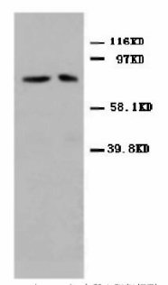 Mitofusin 2 / MFN2 Antibody -  This image was taken for the unconjugated form of this product. Other forms have not been tested.