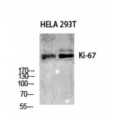 MKI67 / Ki67 Antibody - Western blot of Ki67 antibody