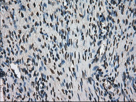 MKI67 / Ki67 Antibody - Immunohistochemical staining of paraffin-embedded Ovary tissue using anti-MKI67 mouse monoclonal antibody. (Dilution 1:50).