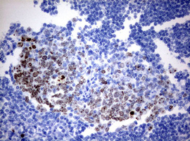 MKI67 / Ki67 Antibody - IHC of paraffin-embedded Human tonsil using anti-MKI67 mouse monoclonal antibody. (Heat-induced epitope retrieval by 10mM citric buffer, pH6.0, 120°C for 3min).