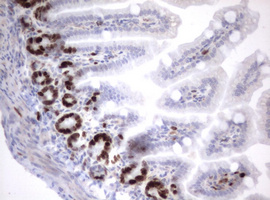 MKI67 / Ki67 Antibody - IHC of paraffin-embedded Mouse colon tissue using anti-MKI67 mouse monoclonal antibody. (heat-induced epitope retrieval by 10mM citric buffer, pH6.0, 120°C for 3min).