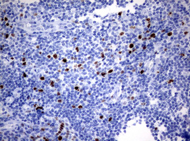 MKI67 / Ki67 Antibody - IHC of paraffin-embedded Human tonsil using anti-MKI67 mouse monoclonal antibody. (Heat-induced epitope retrieval by 10mM citric buffer, pH6.0, 120°C for 3min).