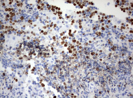 MKI67 / Ki67 Antibody - IHC of paraffin-embedded Human lymph node tissue using anti-MKI67 mouse monoclonal antibody. (Heat-induced epitope retrieval by 10mM citric buffer, pH6.0, 120°C for 3min).