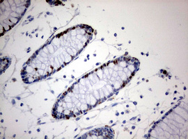 MKI67 / Ki67 Antibody - IHC of paraffin-embedded Human colon tissue using anti-MKI67 mouse monoclonal antibody. (Heat-induced epitope retrieval by 10mM citric buffer, pH6.0, 120°C for 3min).