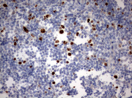 MKI67 / Ki67 Antibody - IHC of paraffin-embedded Human tonsil using anti-MKI67 mouse monoclonal antibody. (Heat-induced epitope retrieval by 10mM citric buffer, pH6.0, 120°C for 3min).