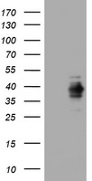 MKI67 / Ki67 Antibody - E.coli lysate (left lane) and E.coli lysate expressing human recombinant protein fragment corresponding to amino acids 1160-1493 of human MKI67 (NP_002408) were separated by SDS-PAGE and immunoblotted with anti-MKI67.