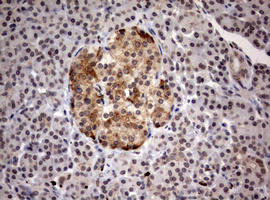 MKI67 / Ki67 Antibody - IHC of paraffin-embedded Human pancreas tissue using anti-MKI67 mouse monoclonal antibody. (Heat-induced epitope retrieval by 10mM citric buffer, pH6.0, 120°C for 3min).