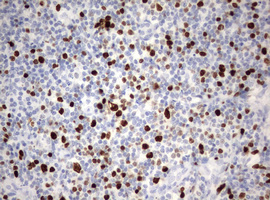 MKI67 / Ki67 Antibody - IHC of paraffin-embedded Human lymph node tissue using anti-MKI67 mouse monoclonal antibody. (Heat-induced epitope retrieval by 10mM citric buffer, pH6.0, 120°C for 3min).