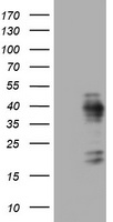 MKI67 / Ki67 Antibody - E.coli lysate (left lane) and E.coli lysate expressing human recombinant protein fragment corresponding to amino acids 1160-1493 of human MKI67 (NP_002408) were separated by SDS-PAGE and immunoblotted with anti-MKI67.