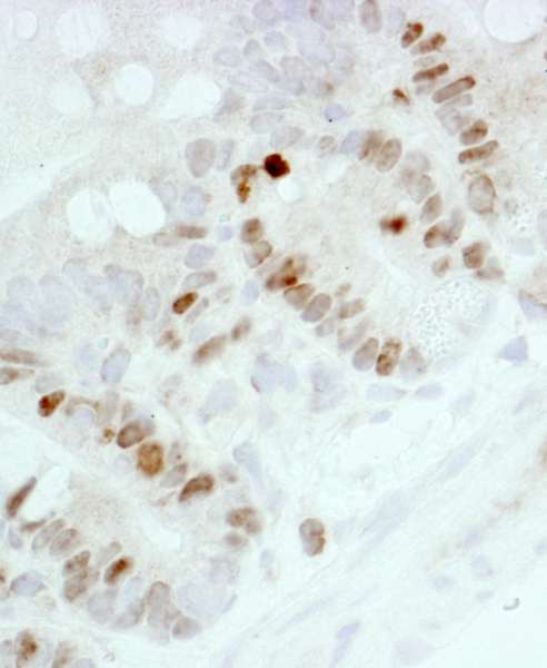 MKI67 / Ki67 Antibody - Detection of Mouse Ki-67 by Immunohistochemistry. Sample: FFPE section of mouse intestine. Antibody: Affinity purified rabbit anti-mouse Ki-67 used at a dilution of 1:250. Epitope Retrieval Buffer-High pH (IHC-101J) was substituted for Epitope Retrieval Buffer-Reduced pH.