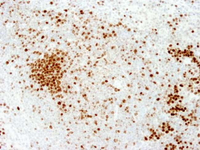 MKI67 / Ki67 Antibody - Detection of Mouse Ki-67 by Immunohistochemistry. Sample: FFPE section of mouse spleen. Antibody: Affinity purified rabbit anti-mouse Ki-67 used at a dilution of 1:250. Epitope Retrieval Buffer-High pH (IHC-101J) was substituted for Epitope Retrieval Buffer-Reduced pH.