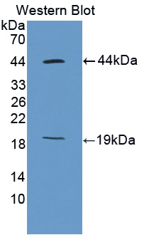 MKI67 / Ki67 Antibody - Western blot of MKI67 / Ki67 antibody.