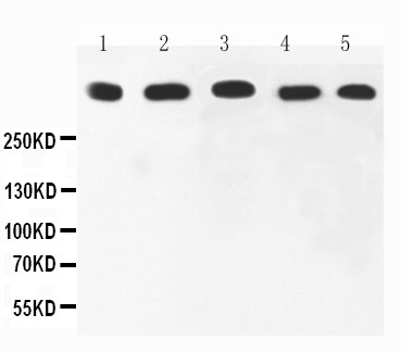 MKI67 / Ki67 Antibody - WB of MKI67 / Ki67 antibody. All lanes: Anti-Ki67 at 0.5ug/ml. Lane 1: HELA Whole Cell Lysate at 40ug. Lane 2: MCF-7 Whole Cell Lysate at 40ug. Lane 3: COLO320 Whole Cell Lysate at 40ug. Lane 4: HEPG2 Whole Cell Lysate at 40ug. Lane 5: SKOV Whole Cell Lysate at 40ug. Predicted bind size: 358KD. Observed bind size: 358KD.