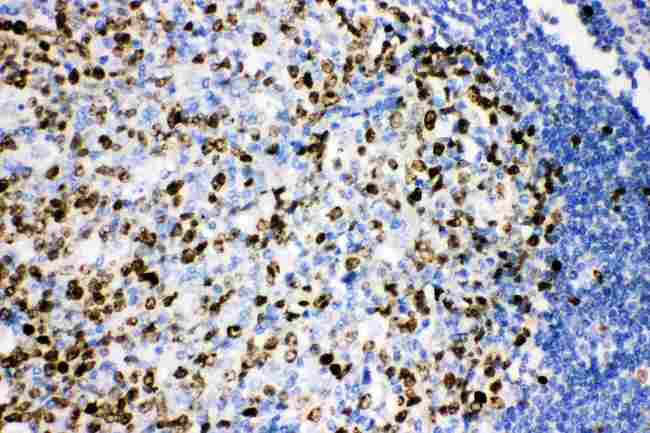 MKI67 / Ki67 Antibody - Anti-Ki67 Picoband antibody,-1. JPGIHC(P): Human Tonsil Tissue