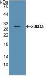 MKI67 / Ki67 Antibody - Western Blot; Sample: Recombinant Ki67P, Human.