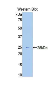 MKI67 / Ki67 Antibody - Western blot of recombinant MKI67 / Ki67.  This image was taken for the unconjugated form of this product. Other forms have not been tested.