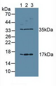 MKI67 / Ki67 Antibody - Western Blot; Sample: Lane1: Human Placenta Tissue; Lane2: Human PC-3 Cells; Lane3: Human MCF7 Cells.