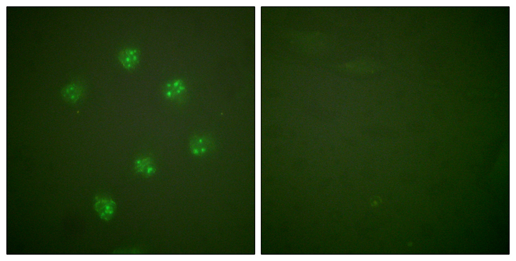 MKI67 / Ki67 Antibody - Immunofluorescence analysis of COS7 cells, using Ki67 Antibody. The picture on the right is blocked with the synthesized peptide.