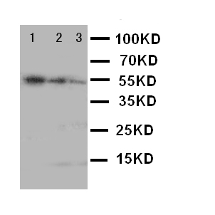 MKI67 / Ki67 Antibody - WB of MKI67 / Ki67 antibody. Recombinant Protein Detection Source:. E.coli derived -recombinant Human Ki67 50.3KD. (162aa tag+ K2967-I3256). Lane 1: Recombinant Human Ki67 Protein 10ng. Lane 2: Recombinant Human Ki67 Protein 5ng. Lane 3: Recombinant Human Ki67 Protein 2.5ng.
