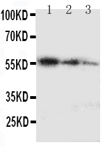 MKI67 / Ki67 Antibody - Anti-Ki67 antibody, Western blottingRecombinant Protein Detection Source: E. coli derived -recombinant Human Ki67 50.3KD (162aa tag+ K2967-I3256)Lane 1: Recombinant Human Ki67 Protein 10ng Lane 2: Recombinant Human Ki67 Protein 5ng Lane 3: Recombinant Human Ki67 Protein 2. 5ng