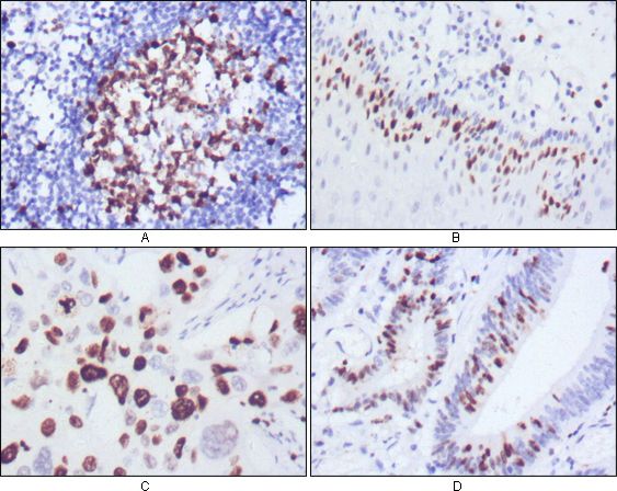 MKI67 / Ki67 Antibody - Ki-67 Antibody in Immunohistochemistry (IHC)