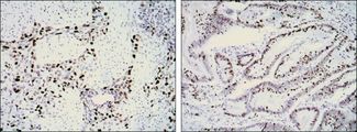 MKI67 / Ki67 Antibody - Ki-67 Antibody in Immunohistochemistry (IHC)