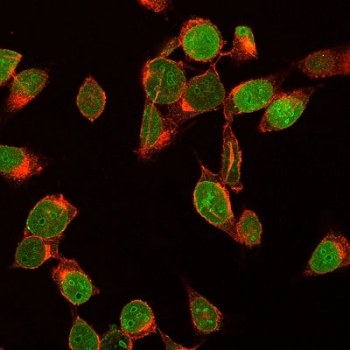 MKI67 / Ki67 Antibody - IF staining of human HeLa cells with Ki67 antibody (green, clone MKI67/2461) and wheat germ agglutinin (red, membrane stain).