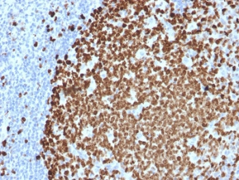 MKI67 / Ki67 Antibody - IHC testing of FFPE human tonsil stained with Ki67 antibody (MKI67/2461). Required HIER: boiling tissue sections in 10mM citrate buffer, pH6, for 10-20 min followed by cooling at RT for 20 min.