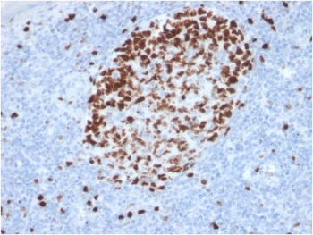 MKI67 / Ki67 Antibody - IHC testing of FFPE human tonsil stained with Ki67 antibody (MKI67/2462). Required HIER: boiling tissue sections in 10mM citrate buffer, pH6, for 10-20 min followed by cooling at RT for 20 min.
