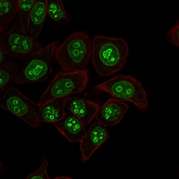 MKI67 / Ki67 Antibody - IF staining of human HeLa cells with Ki-67 antibody (green, clone MKI67/2462) and Phalloidin (red, membrane stain).