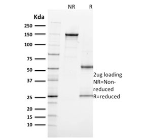 MKI67 / Ki67 Antibody - SDS-PAGE analysis of purified, BSA-free Ki67 antibody (clone MKI67/2462) as confirmation of integrity and purity.