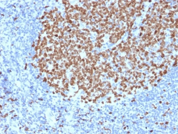 MKI67 / Ki67 Antibody - IHC testing of FFPE human tonsil stained with Ki67 antibody (MKI67/2463). Required HIER: boiling tissue sections in 10mM citrate buffer, pH6, for 10-20 min followed by cooling at RT for 20 min.