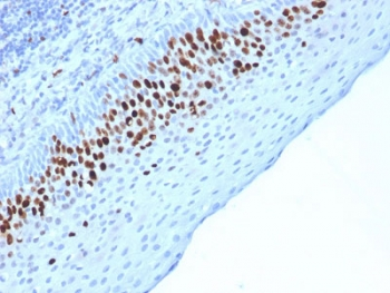 MKI67 / Ki67 Antibody - IHC testing of FFPE human skin stained with Ki67 antibody (MKI67/2463). Required HIER: boiling tissue sections in 10mM citrate buffer, pH6, for 10-20 min followed by cooling at RT for 20 min.