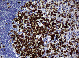 MKI67 / Ki67 Antibody - IHC of paraffin-embedded Human tonsil using anti-MKI67 mouse monoclonal antibody.