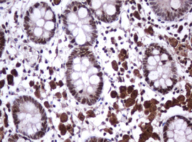 MKI67 / Ki67 Antibody - IHC of paraffin-embedded Human colon tissue using anti-MKI67 mouse monoclonal antibody.